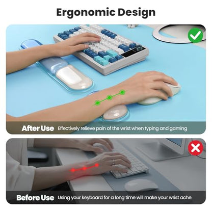 TECKNET Clear Gel Wrist Rest for Computer Keyboard, Ergonomic Gel Keyboard Wrist Rest Set for Typing Pain Relief, Comfortable Silicone Wrist Support Pad for Office/Computer/Laptop/Gaming, Blue