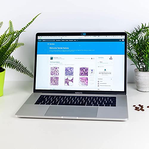 CloudValley Camera Cover Slide Ultra-Thin, Blue Webcam Cover for MacBook air, Laptop, iMac, Desktop, PC, MacBook Pro, iPad, iPhone 8/7/6, Privacy Web Camera Protection [2 Packs] - color: Blue-2 Pcs